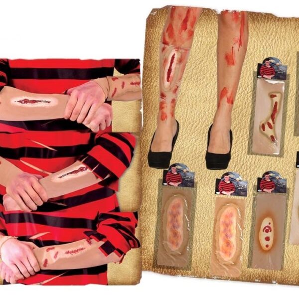 Herida con brazo de piel